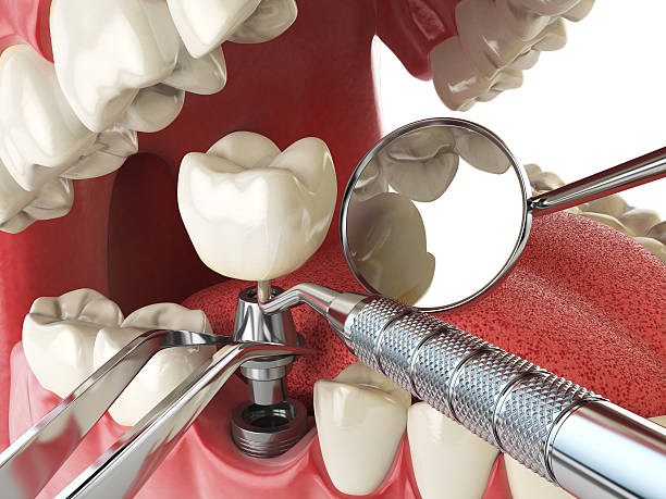 Best Emergency Treatment for Oral Infections in Clinton, SC